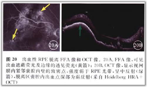 http://webres.medlive.cn/upload/000/105/825