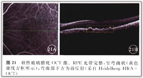 http://webres.medlive.cn/upload/000/105/826