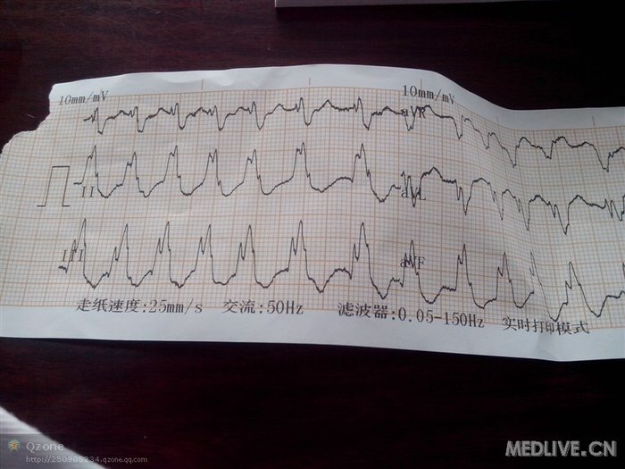 http://webres.medlive.cn/upload/000/113/885