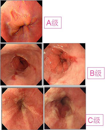 http://webres.medlive.cn/upload/000/125/241