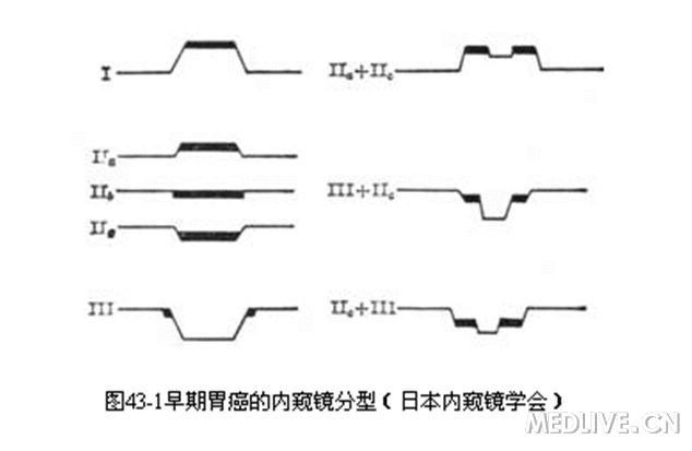 http://webres.medlive.cn/upload/000/125/243