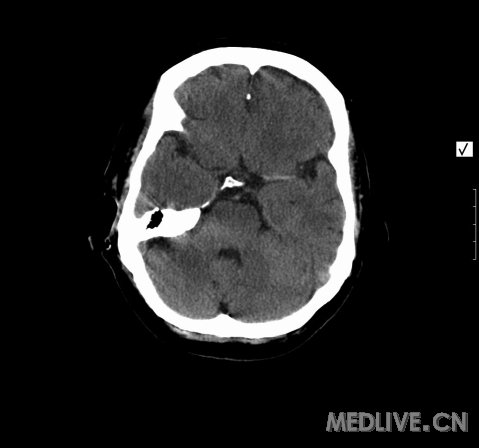 http://webres.medlive.cn/upload/000/131/557
