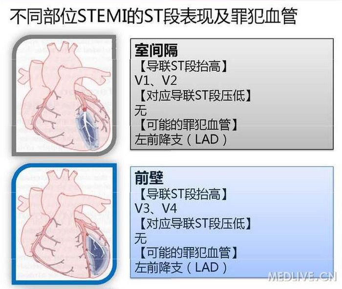 http://webres.medlive.cn/upload/000/149/387
