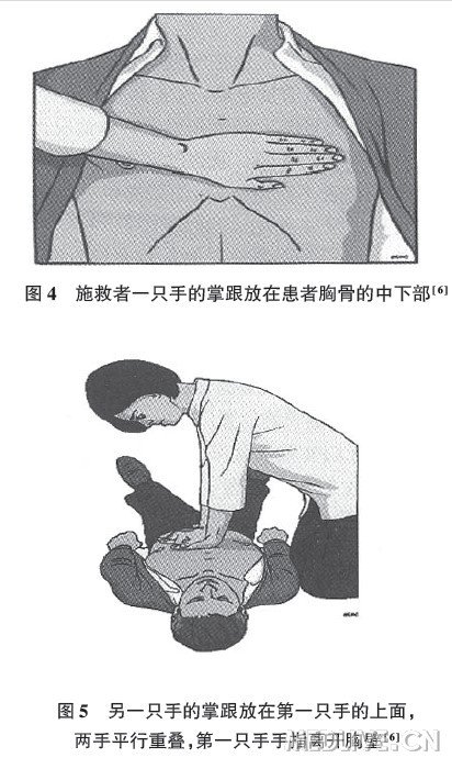 http://webres.medlive.cn/upload/000/150/741