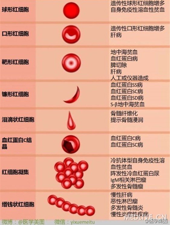 清晰图解红细胞异常及相关疾病
