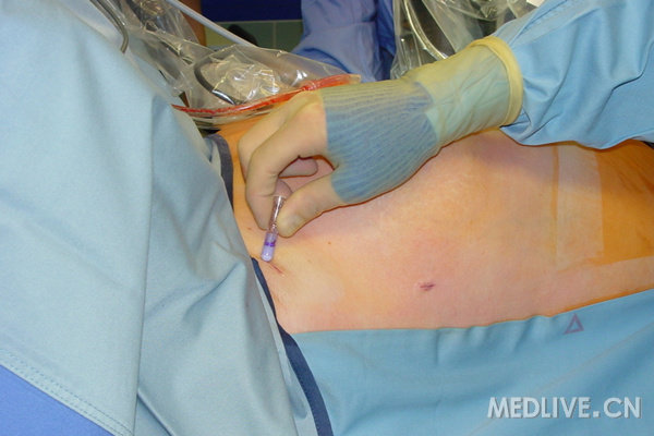 http://webres.medlive.cn/upload/000/164/372