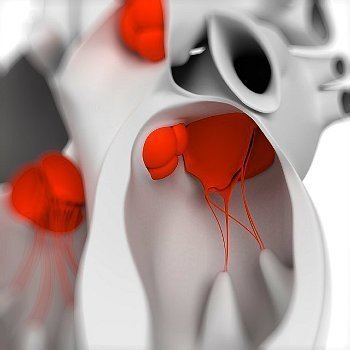 http://webres.medlive.cn/upload/000/170/396