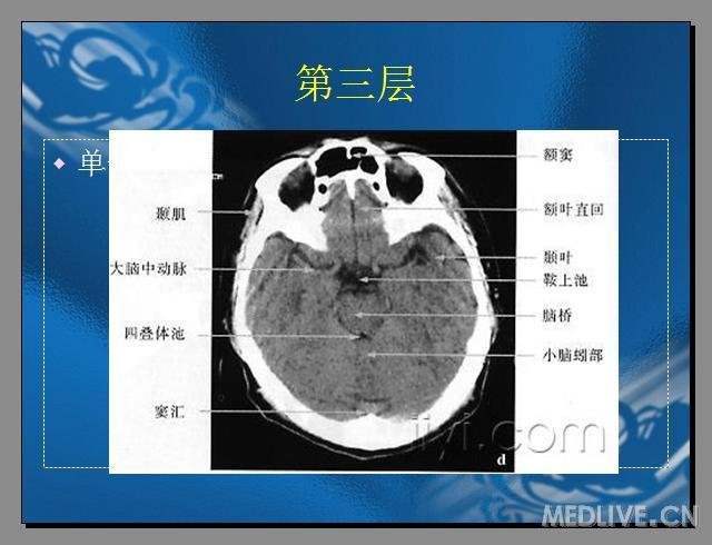 http://webres.medlive.cn/upload/000/173/658