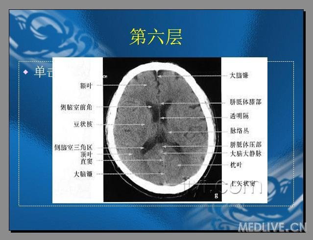 http://webres.medlive.cn/upload/000/173/661