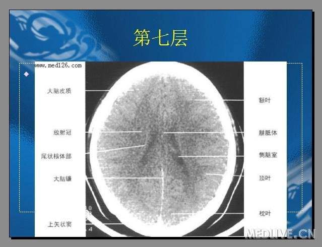 http://webres.medlive.cn/upload/000/173/662