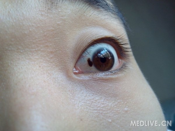http://webres.medlive.cn/upload/000/177/372