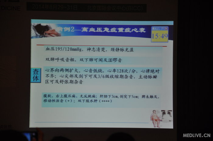 http://webres.medlive.cn/upload/000/185/433
