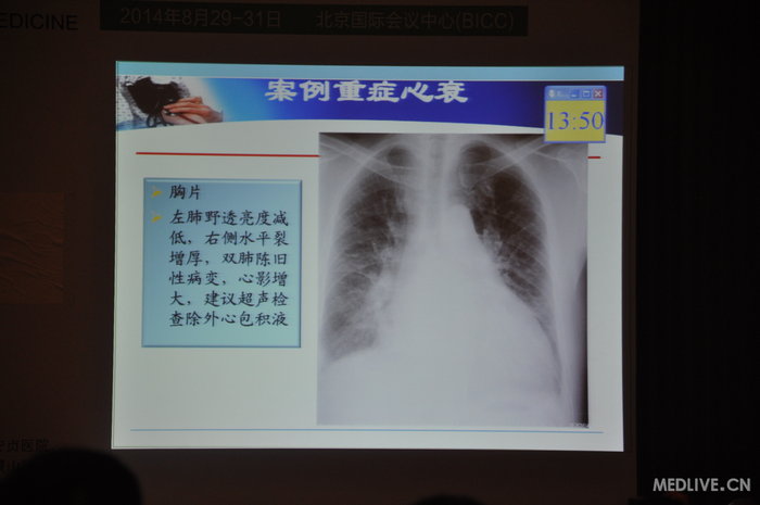 http://webres.medlive.cn/upload/000/185/437