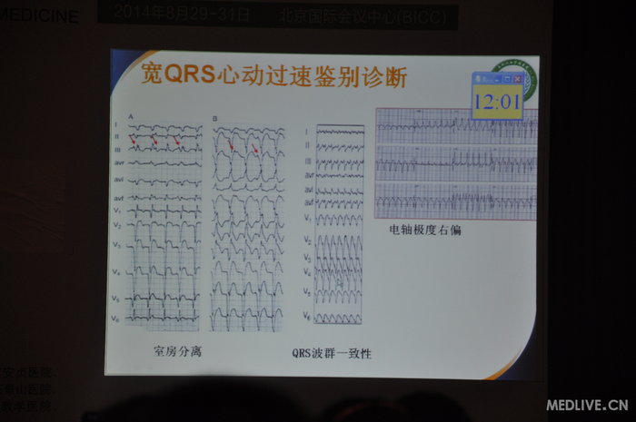 http://webres.medlive.cn/upload/000/185/677
