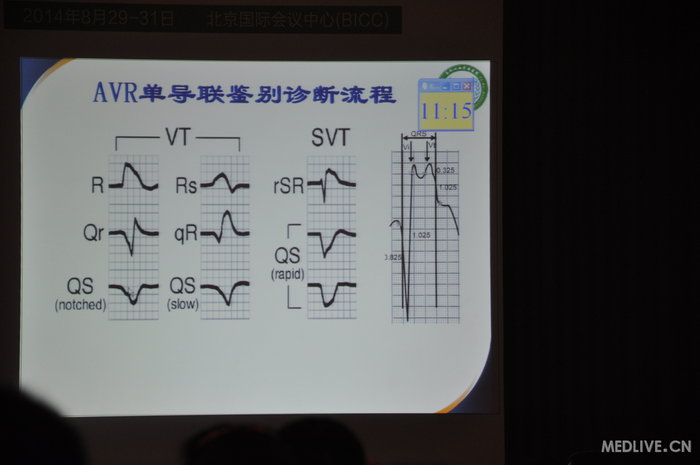 http://webres.medlive.cn/upload/000/185/678