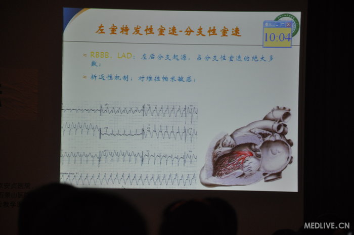 http://webres.medlive.cn/upload/000/185/681