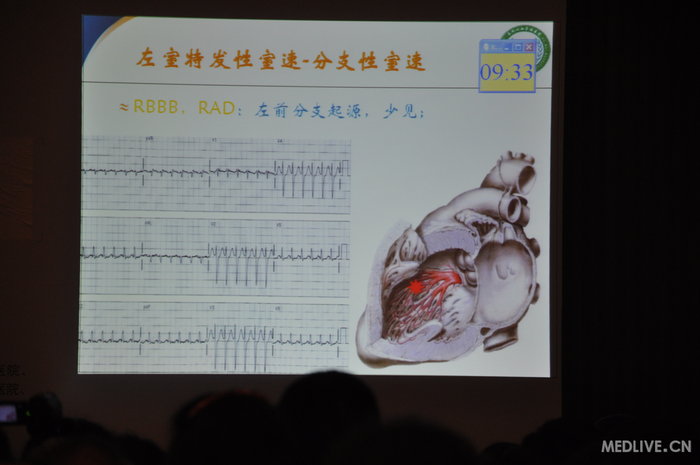 http://webres.medlive.cn/upload/000/185/682