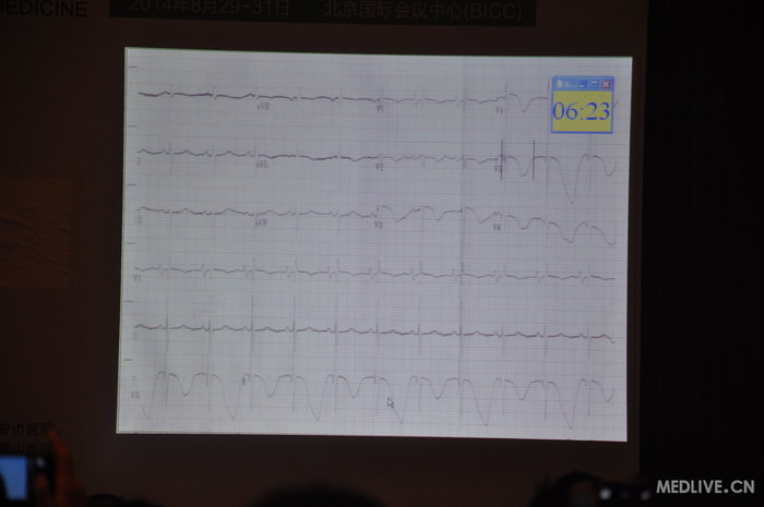 http://webres.medlive.cn/upload/000/185/693