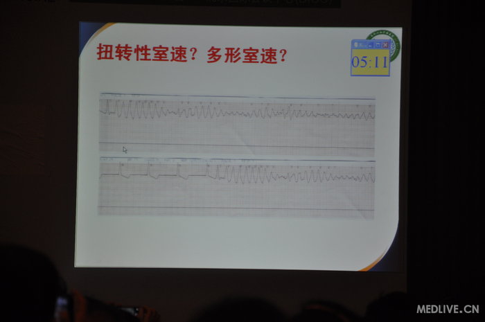 http://webres.medlive.cn/upload/000/185/696