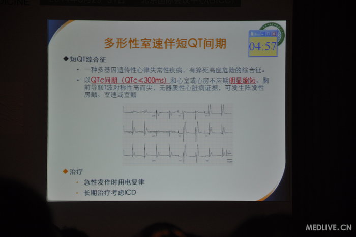 http://webres.medlive.cn/upload/000/185/697
