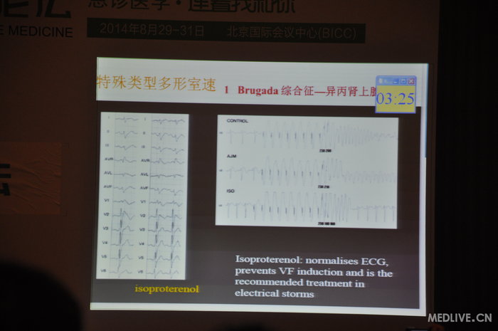http://webres.medlive.cn/upload/000/185/702