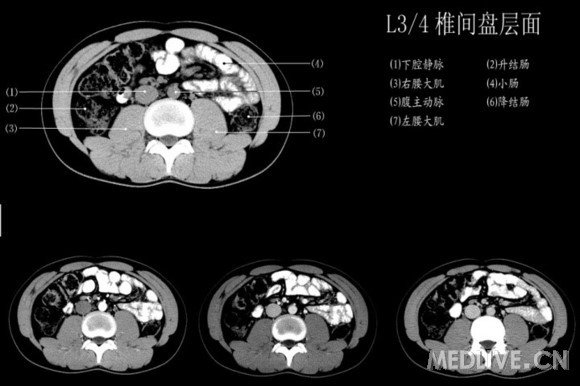 http://webres.medlive.cn/upload/000/214/198