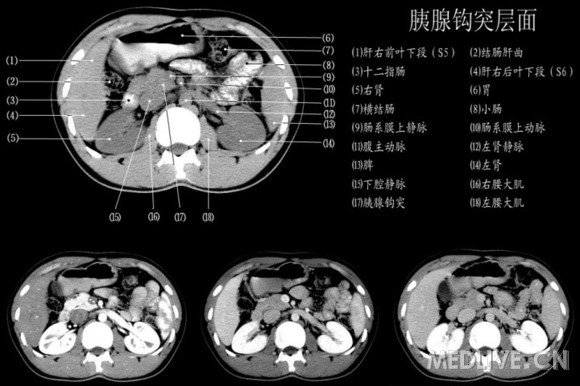 http://webres.medlive.cn/upload/000/214/199