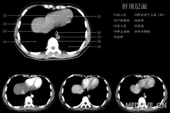 http://webres.medlive.cn/upload/000/214/200