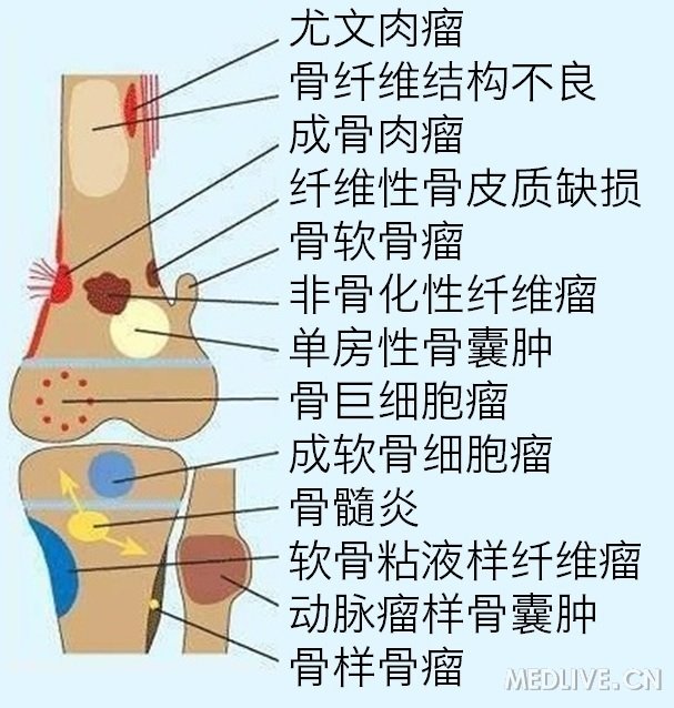 http://webres.medlive.cn/upload/000/245/202