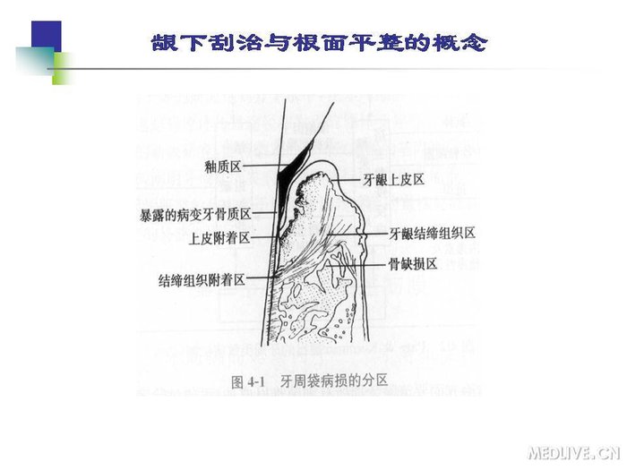 http://webres.medlive.cn/upload/000/254/162