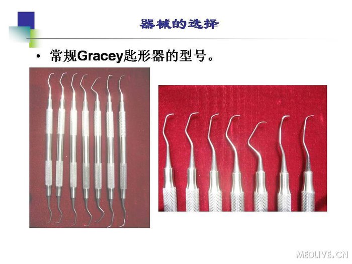 http://webres.medlive.cn/upload/000/254/183