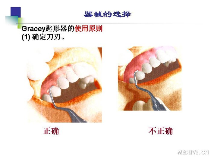 http://webres.medlive.cn/upload/000/254/187