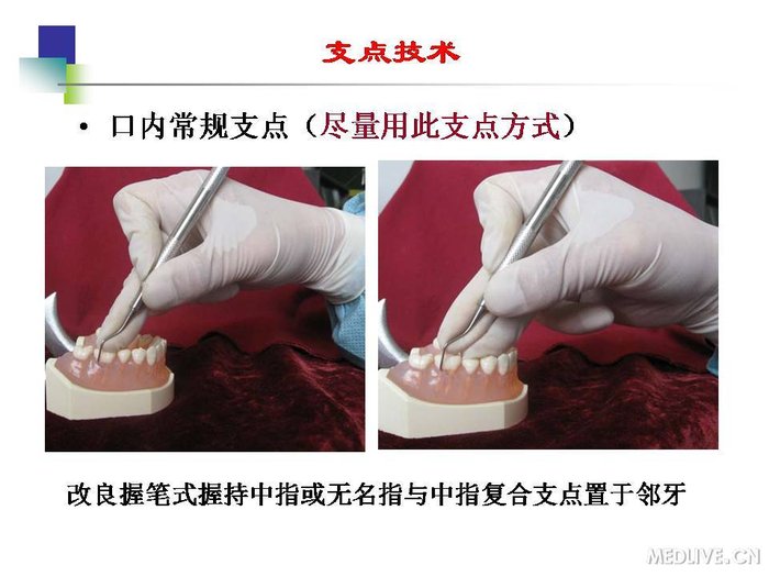 http://webres.medlive.cn/upload/000/254/191