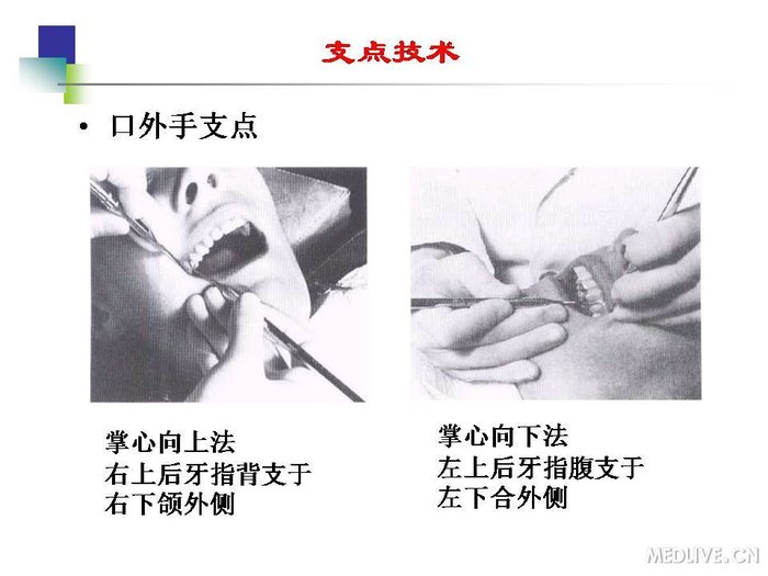 http://webres.medlive.cn/upload/000/254/194