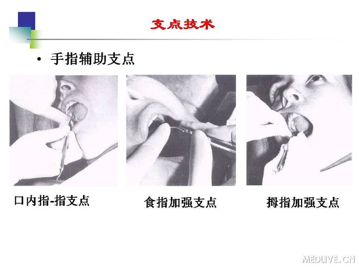 http://webres.medlive.cn/upload/000/254/195