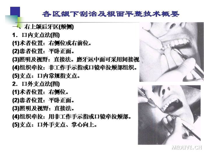 http://webres.medlive.cn/upload/000/254/210
