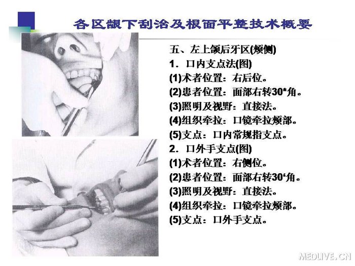 http://webres.medlive.cn/upload/000/254/213