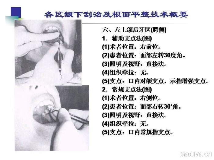 http://webres.medlive.cn/upload/000/254/214