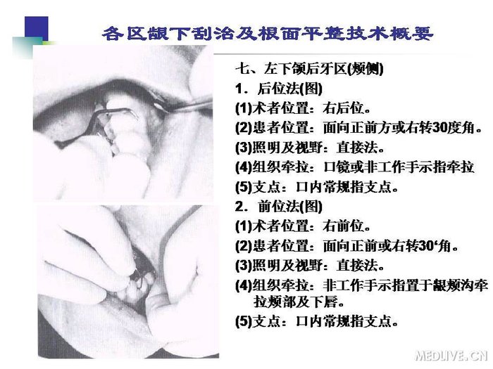 http://webres.medlive.cn/upload/000/254/215