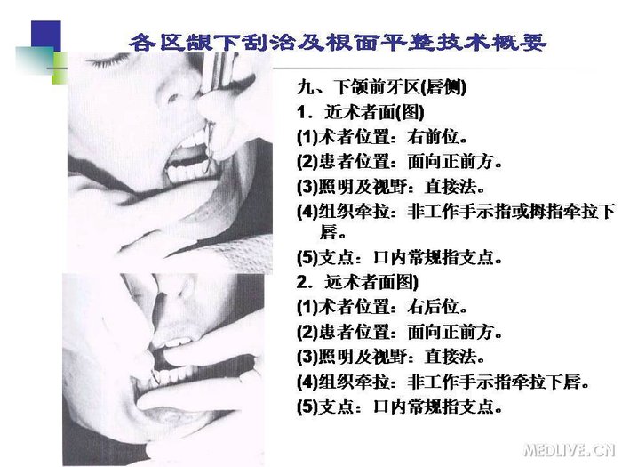 http://webres.medlive.cn/upload/000/254/217