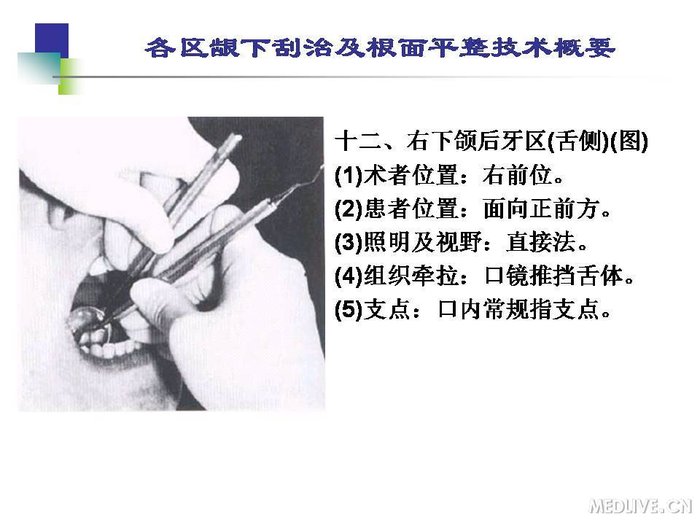 http://webres.medlive.cn/upload/000/254/220