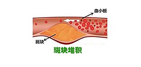 http://webres.medlive.cn/upload/000/274/284