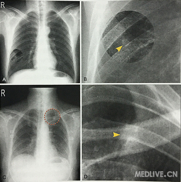 http://webres.medlive.cn/upload/000/298/143