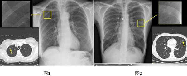 http://webres.medlive.cn/upload/000/298/146