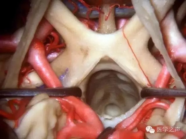 http://webres.medlive.cn/upload/000/321/944