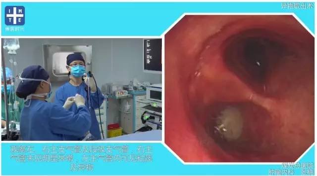 http://webres.medlive.cn/upload/000/325/735