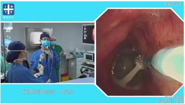 http://webres.medlive.cn/upload/000/325/736