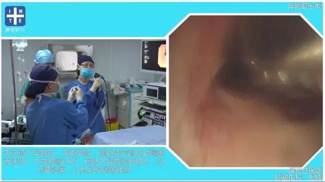 http://webres.medlive.cn/upload/000/325/737