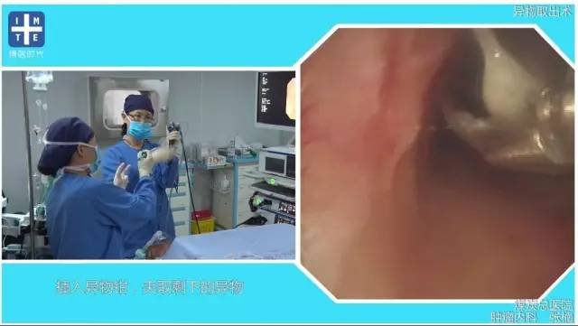 http://webres.medlive.cn/upload/000/325/738