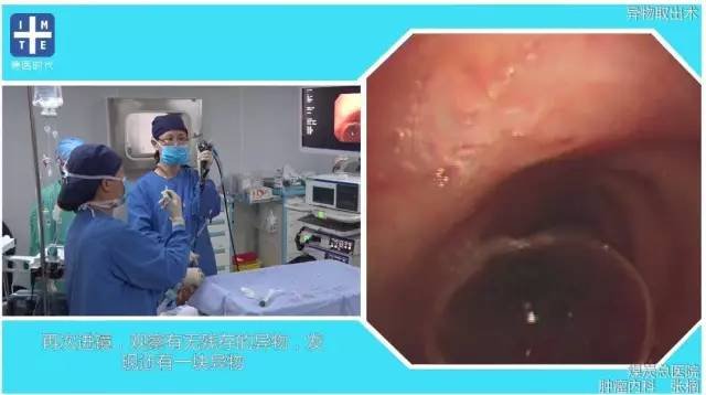 http://webres.medlive.cn/upload/000/325/739